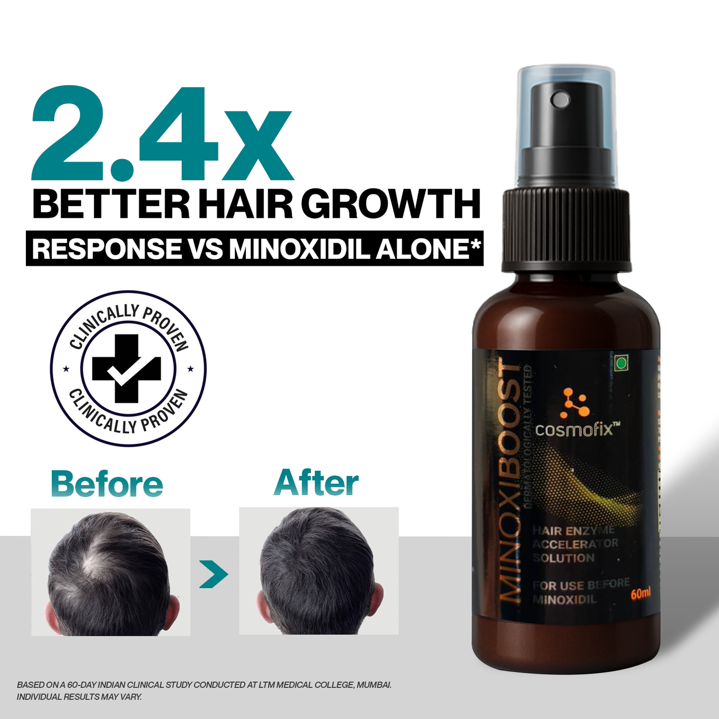 Cosmofix Minoxiboost | Clinically Proven Hair Regrowth Serum