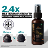 Cosmofix Minoxiboost | Clinically Proven Hair Regrowth Serum